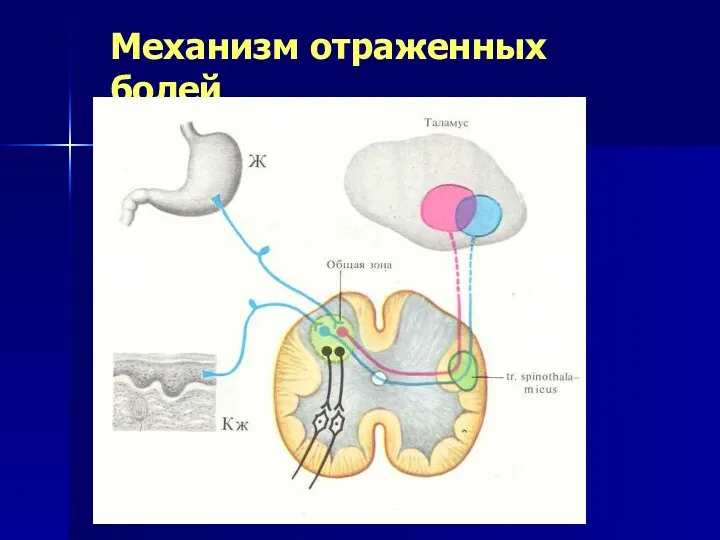 Механизм отраженных болей