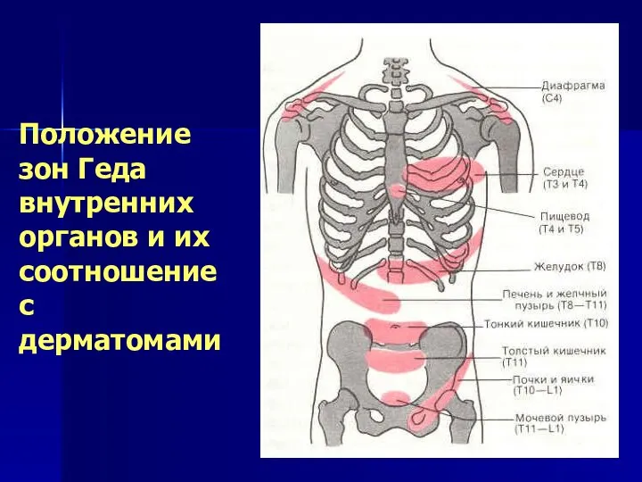 Положение зон Геда внутренних органов и их соотношение с дерматомами