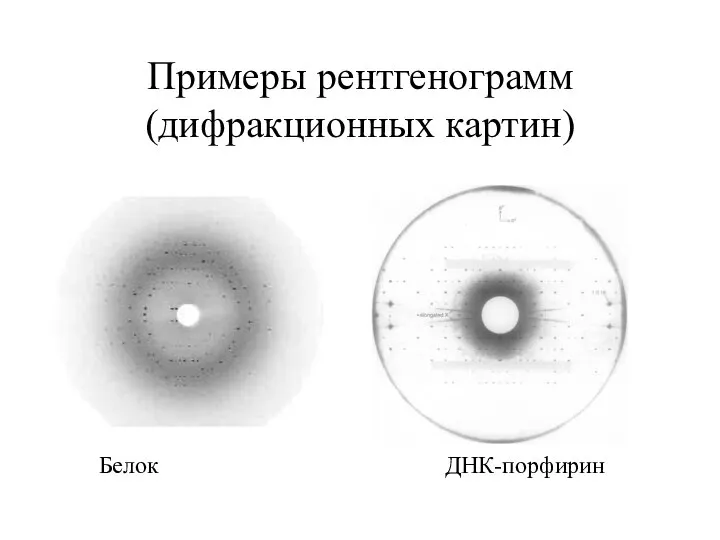 Примеры рентгенограмм (дифракционных картин) Белок ДНК-порфирин