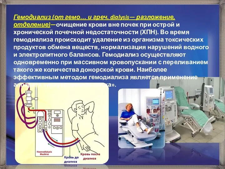 Гемодиализ (от гемо… и греч. dialysis— разложение, отделение)—очищение крови вне почек при