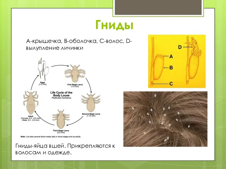 Гниды Гниды-яйца вшей. Прикрепляются к волосам и одежде. А-крышечка, В-оболочка, С-волос, D-вылупление личинки