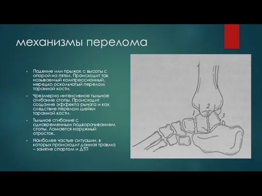 механизмы перелома Падение или прыжок с высоты с опорой на пятки. Происходит