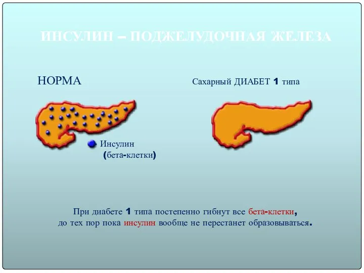 ИНСУЛИН – ПОДЖЕЛУДОЧНАЯ ЖЕЛЕЗА При диабете 1 типа постепенно гибнут все бета-клетки,