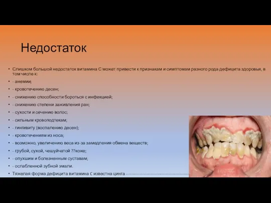 Недостаток Слишком большой недостаток витамина С может привести к признакам и симптомам