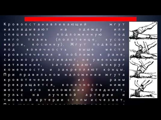 Кровоостанавливающий жгут накладывают на одежду или специально подложенную под него ткань (полотенце,