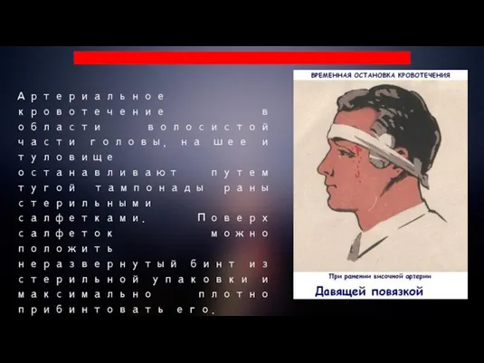 Артериальное кровотечение в области волосистой части головы, на шее и туловище останавливают