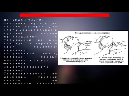 ПРИЗНАКИ ЖИЗНИ: —наличие пульса на сонной артерии. Для этого указательный и средний