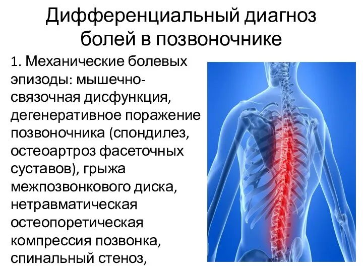 Дифференциальный диагноз болей в позвоночнике 1. Механические болевых эпизоды: мышечно-связочная дисфункция, дегенеративное