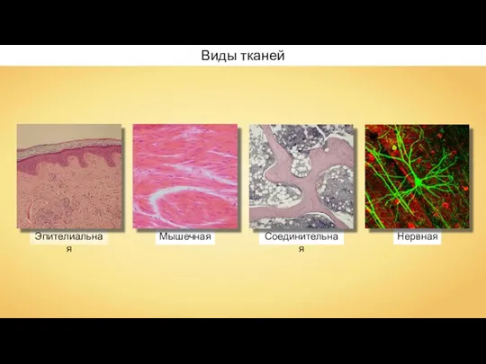 Мышечная Эпителиальная Соединительная Нервная Виды тканей