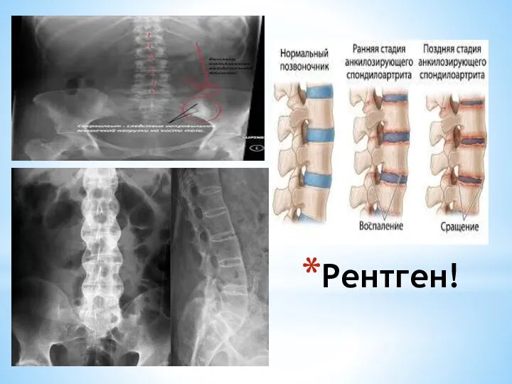 Рентген!