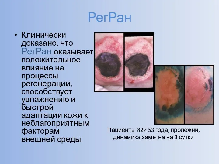 РегРан Клинически доказано, что РегРан оказывает положительное влияние на процессы регенерации, способствует