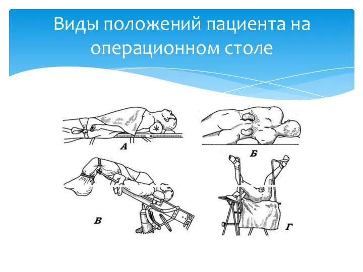 Виды положений пациента на операционном столе