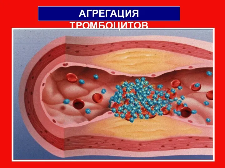 АГРЕГАЦИЯ ТРОМБОЦИТОВ