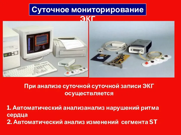 Суточное мониторирование ЭКГ При анализе суточной суточной записи ЭКГ осуществляется 1. Автоматический