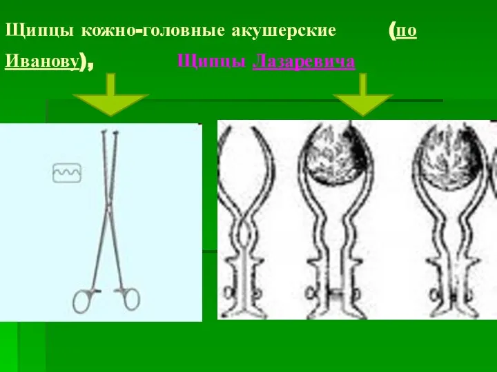 Щипцы кожно-головные акушерские (по Иванову), Щипцы Лазаревича