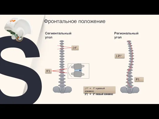 S Фронтальное положение ) 21° 9°( ( 4° 5°) ) 1° =