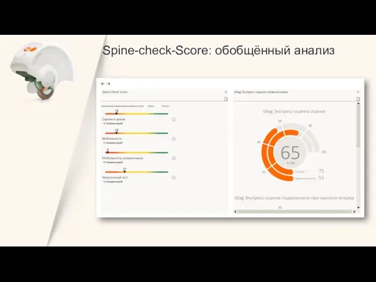 Spine-check-Score: обобщённый анализ