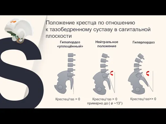 Крестец/таз = 0 Крестец/таз > 0 примерно до ( ø ~13°) Крестец/таз>>