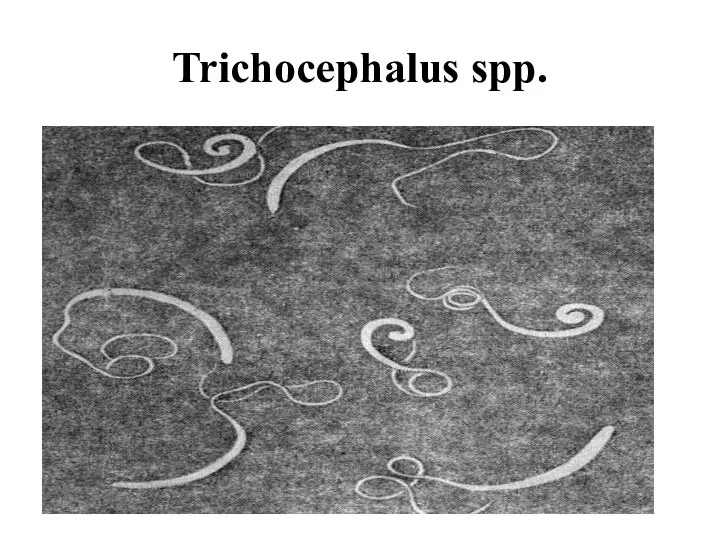 Trichocephalus spp.