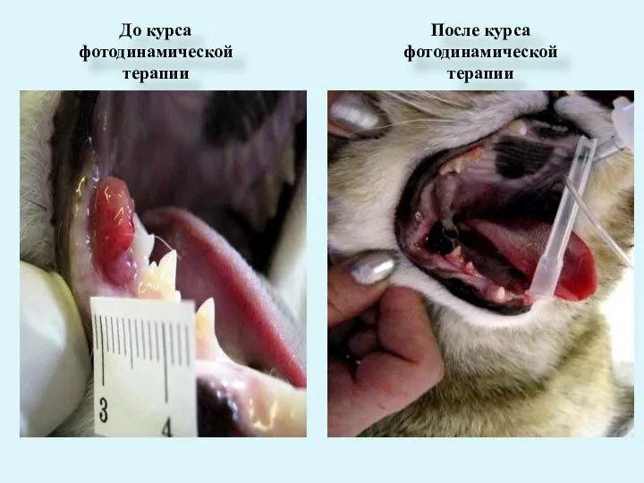 До курса фотодинамической терапии После курса фотодинамической терапии