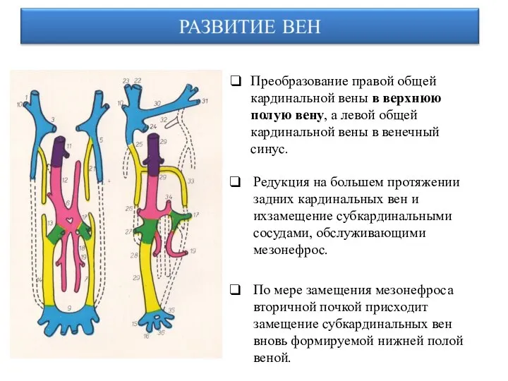 Преобразование правой общей кардинальной вены в верхнюю полую вену, а левой общей