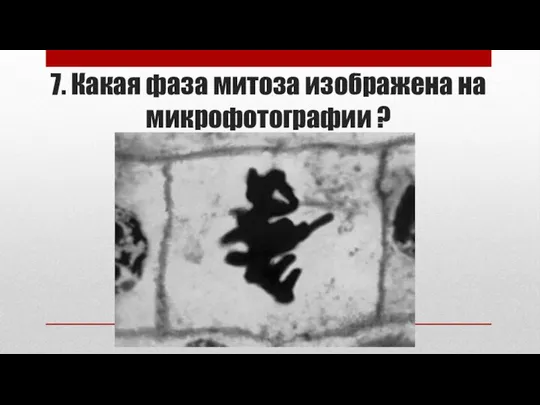 7. Какая фаза митоза изображена на микрофотографии ?