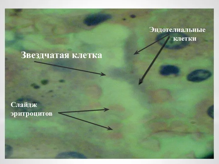 Звездчатая клетка Эндотелиальные клетки Слайдж эритроцитов