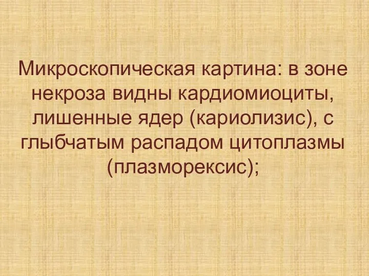 Микроскопическая картина: в зоне некроза видны кардиомиоциты, лишенные ядер (кариолизис), с глыбчатым распадом цитоплазмы (плазморексис);