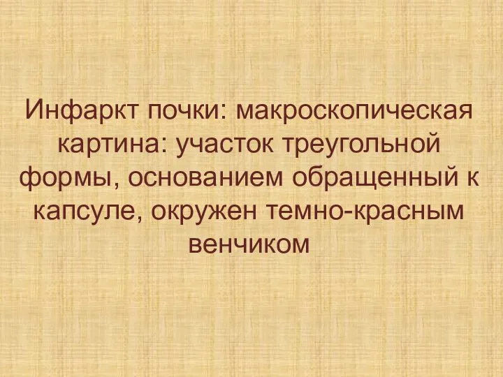 Инфаркт почки: макроскопическая картина: участок треугольной формы, основанием обращенный к капсуле, окружен темно-красным венчиком