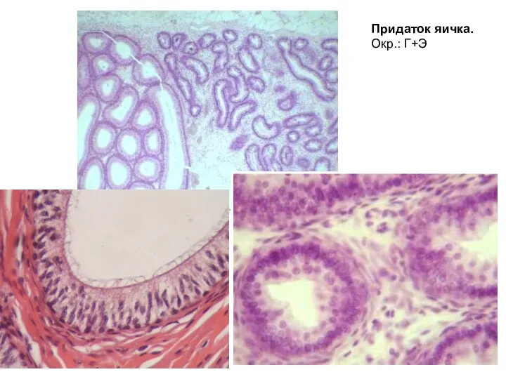Придаток яичка. Окр.: Г+Э