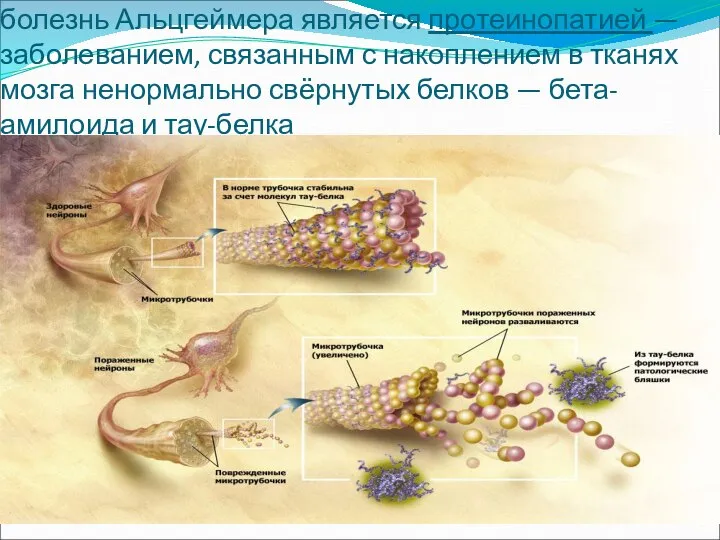болезнь Альцгеймера является протеинопатией — заболеванием, связанным с накоплением в тканях мозга