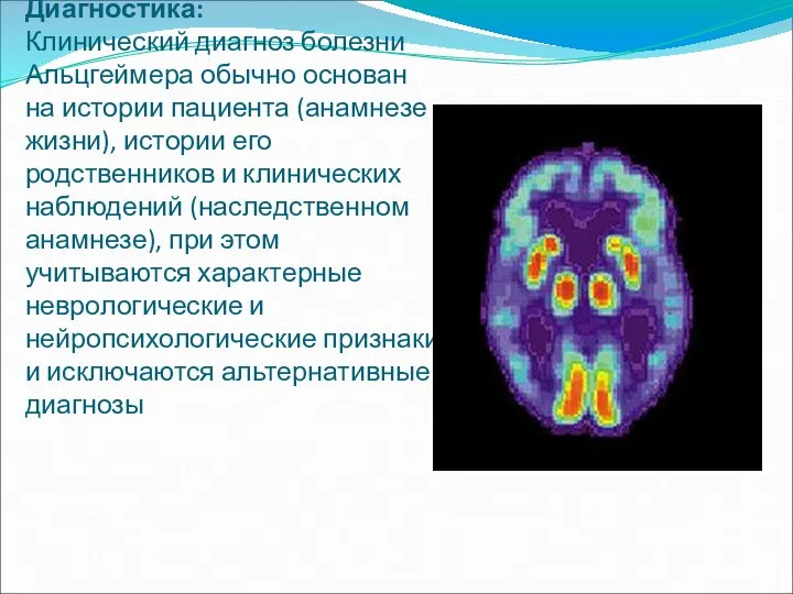 Диагностика: Клинический диагноз болезни Альцгеймера обычно основан на истории пациента (анамнезе жизни),