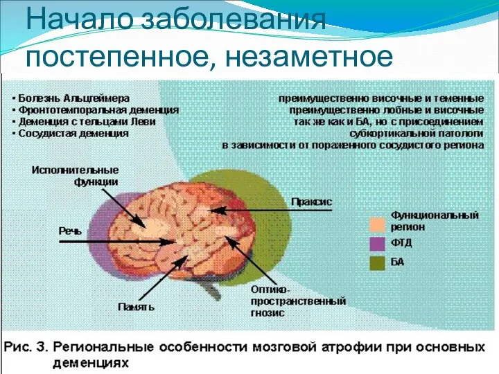 Начало заболевания постепенное, незаметное