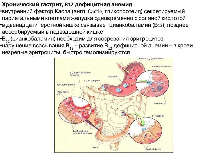 Хронический гастрит, B12 дефицитная анемия внутренний фактор Касла (англ. Cactle; гликопротеид) секретируемый