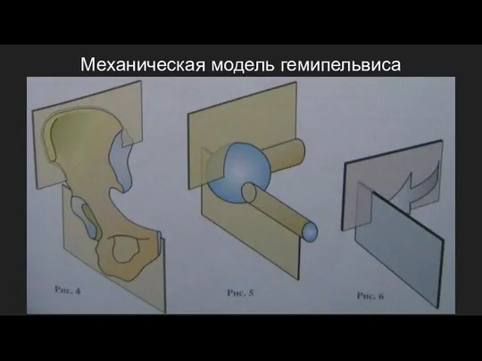 Механическая модель гемипельвиса