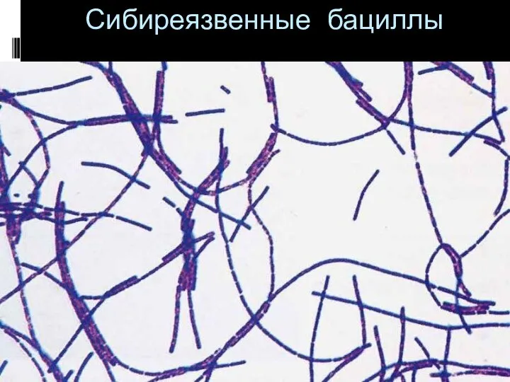 Сибиреязвенные бациллы http://vetfak.nsau.edu.ru/new/uchebnic/microbiology/stu/index_micro.htm