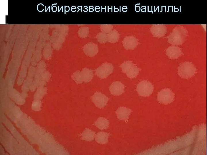 Сибиреязвенные бациллы http://vetfak.nsau.edu.ru/new/uchebnic/microbiology/stu/index_micro.htm