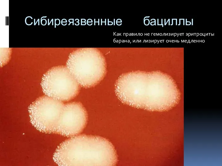 Сибиреязвенные бациллы http://vetfak.nsau.edu.ru/new/uchebnic/microbiology/stu/index_micro.htm Как правило не гемолизирует эритроциты барана, или лизирует очень медленно