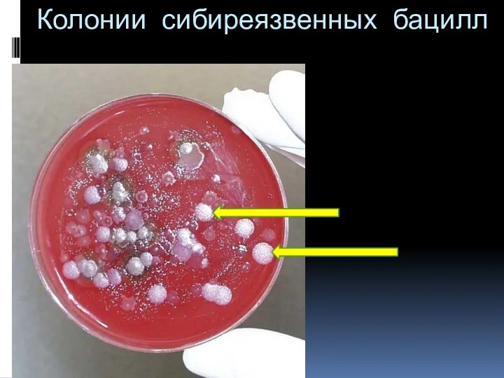 Колонии сибиреязвенных бацилл