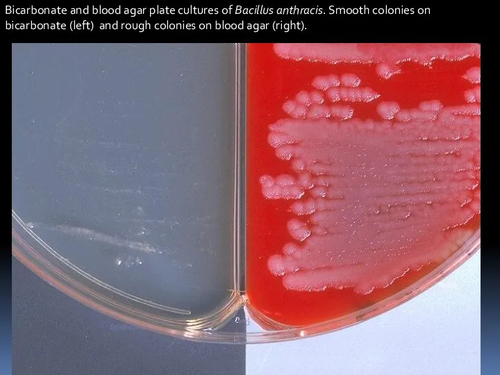 Bicarbonate and blood agar plate cultures of Bacillus anthracis. Smooth colonies on