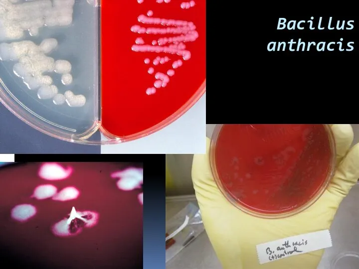 Bacillus anthracis