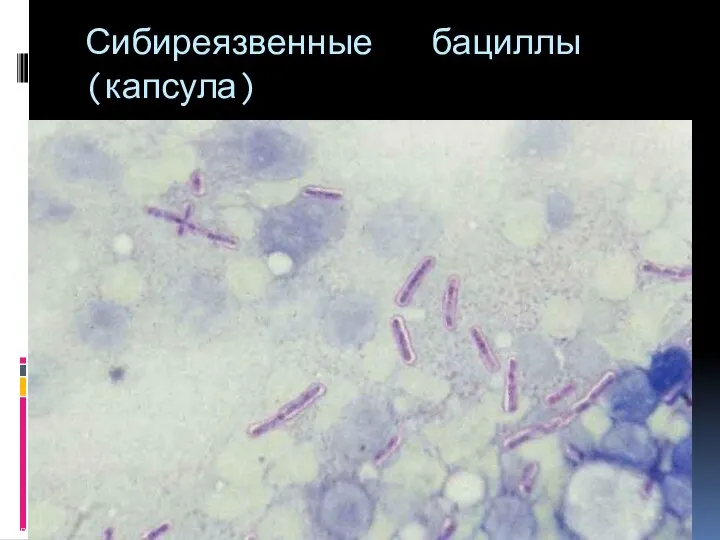 Сибиреязвенные бациллы (капсула) http://vetfak.nsau.edu.ru/new/uchebnic/microbiology/stu/index_micro.htm