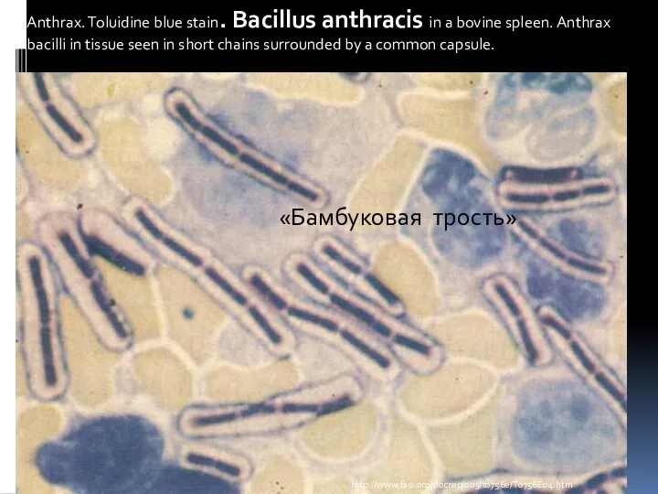 Anthrax. Toluidine blue stain. Bacillus anthracis in a bovine spleen. Anthrax bacilli