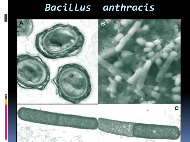 Bacillus anthracis