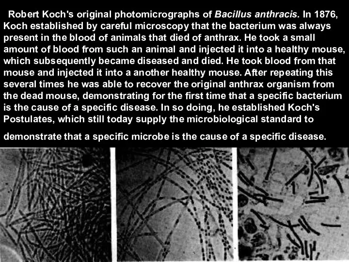 Robert Koch's original photomicrographs of Bacillus anthracis. In 1876, Koch established by