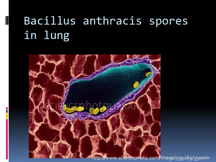 Bacillus anthracis spores in lung http://www.sciencephoto.com/image/799269/350wm