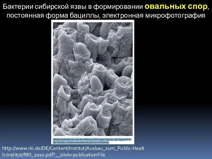 Бактерии сибирской язвы в формировании овальных спор, постоянная форма бациллы, электронная микрофотография http://www.rki.de/DE/Content/Institut/Ausbau_zum_Public-Health-Institut/RKI_2010.pdf?__blob=publicationFile