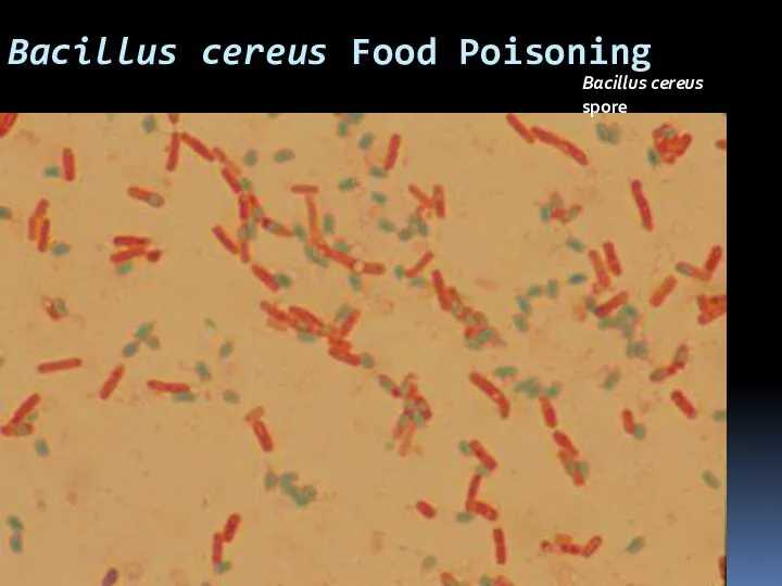 Bacillus cereus Food Poisoning Bacillus cereus spore