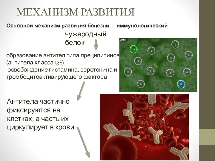 МЕХАНИЗМ РАЗВИТИЯ Основной механизм развития болезни — иммунологический чужеродный белок образование антител