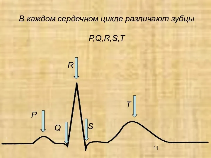 В каждом сердечном цикле различают зубцы P,Q,R,S,T P Q R S T